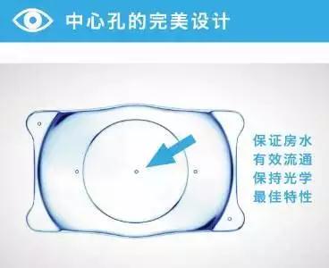 高度近視的“終結(jié)者”——ICL晶體植入術(shù)！